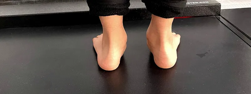 İçe Basma Problemi: Nedenleri ve Çözümleri